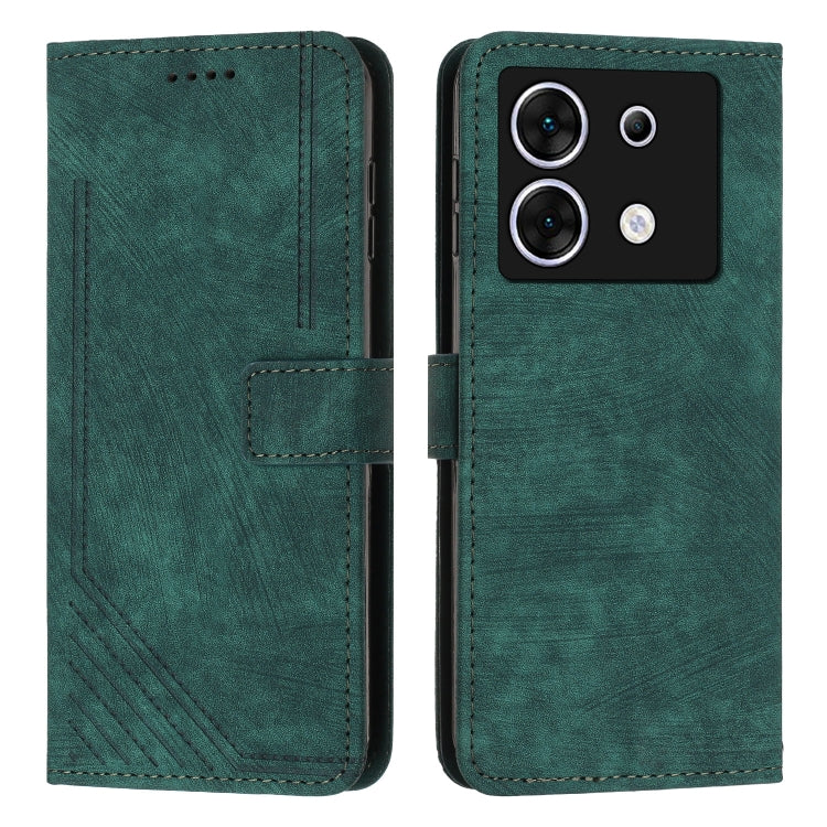 For Infinix Zero 30 5G Skin Feel Stripe Pattern Leather Phone Case with Lanyard(Green) - Infinix Cases by PMC TechLife | Online Shopping South Africa | PMC TechLife | Buy Now Pay Later Mobicred