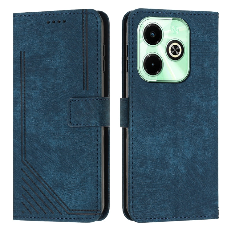 For Infinix Hot 40i Skin Feel Stripe Pattern Leather Phone Case with Lanyard(Blue) - Infinix Cases by PMC TechLife | Online Shopping South Africa | PMC TechLife | Buy Now Pay Later Mobicred