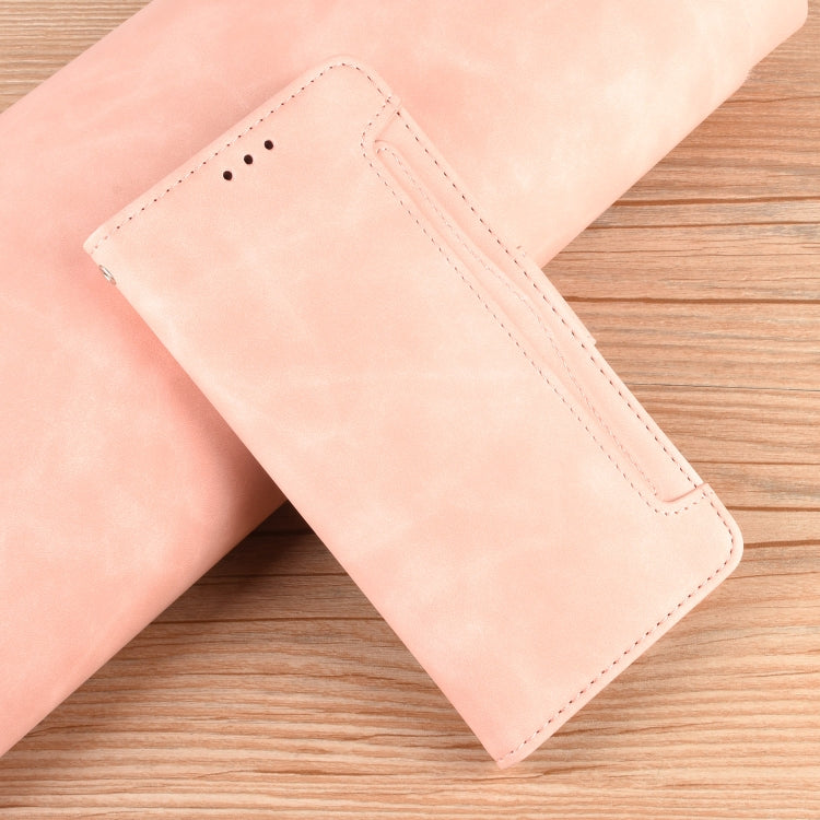 For Ulefone Note 18 Ultra Skin Feel Calf Texture Card Slots Leather Phone Case(Pink) - Ulefone Cases by PMC Jewellery | Online Shopping South Africa | PMC Jewellery | Buy Now Pay Later Mobicred
