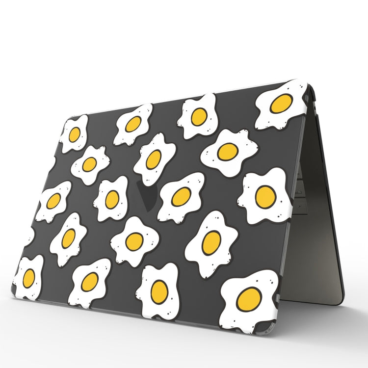 For MacBook Air 11.6 A1370 / A1465 UV Printed Pattern Laptop Frosted Protective Case(DDC-802) - free shipping - PMC Jewellery - Order now!
