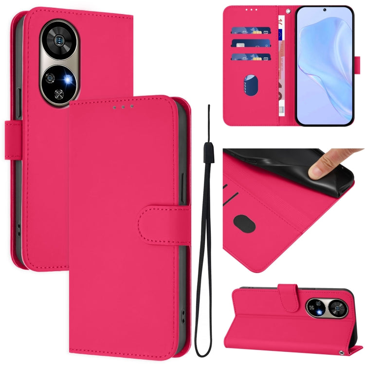 For Ulefone Note 17 Pro Skin Feel Solid Color Leather Phone Case with Lanyard(Rose Red) - Ulefone Cases by PMC Jewellery | Online Shopping South Africa | PMC Jewellery | Buy Now Pay Later Mobicred