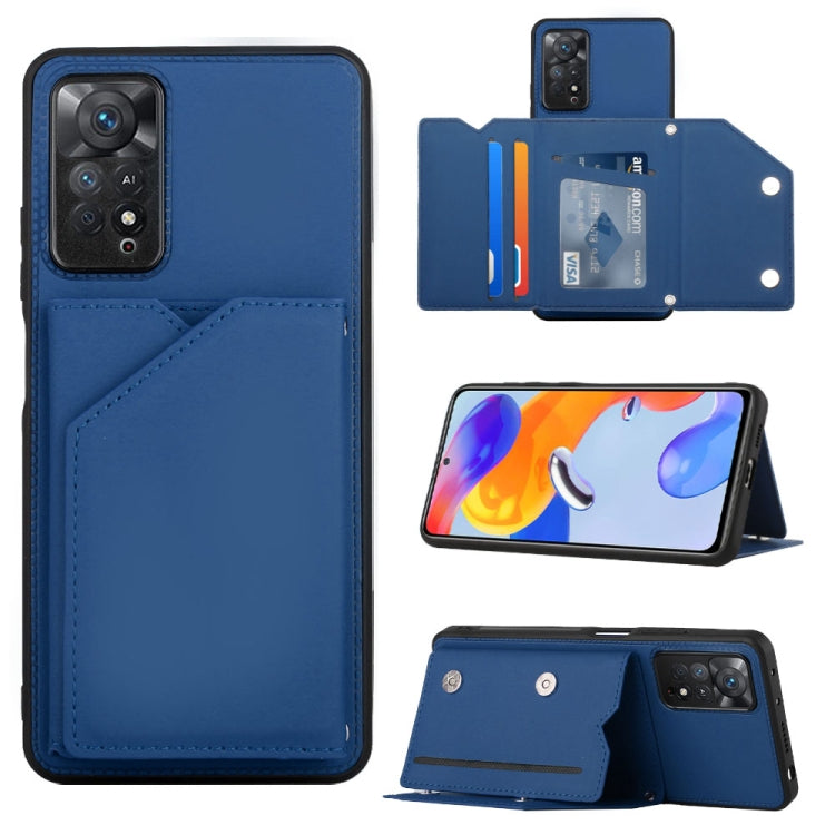 For Xiaomi Redmi Note 11 Pro Global Skin Feel PU + TPU + PC Phone Case(Blue) - free shipping - PMC TechLife - Order now!